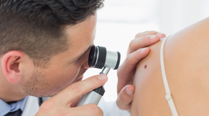 dermatologist inspecting mole